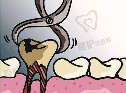 患者在种植前后需要注意什么?