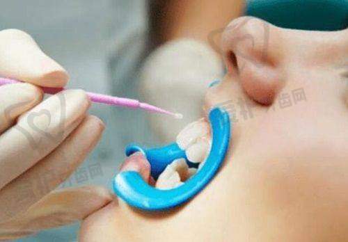 3、上海中喜慧丽口腔曾宪伟医生诊疗项目收费价格: