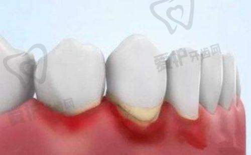 2、太原达美联合口腔侯军 医生种植牙怎么样?