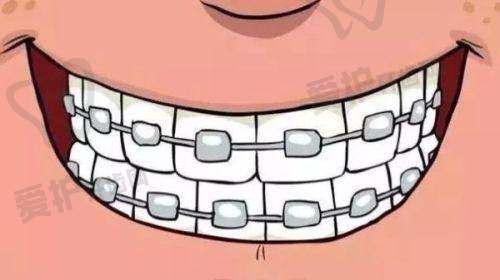 与其他口腔医院相比，广州雅皓口腔医院的E.MAX全瓷冠项目有何优势？