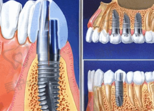 广州雅皓口腔医院在服务方面有哪些亮点？