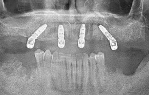 4、云南拜博口腔张晖医生社会职称
