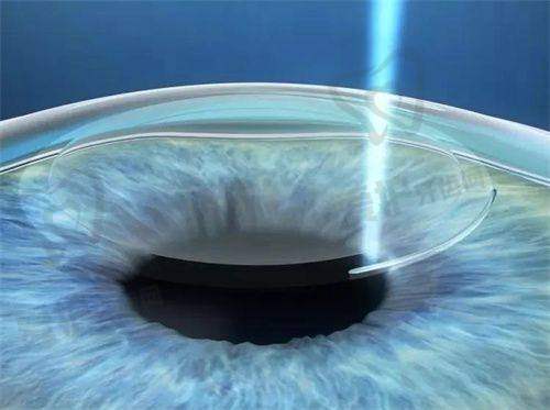 选择建议与注意事项