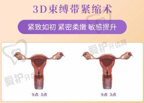 术后修复:需要注意什么?