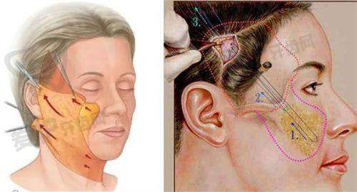 5、哈尔滨瑞丽杨永胜医生患者评价