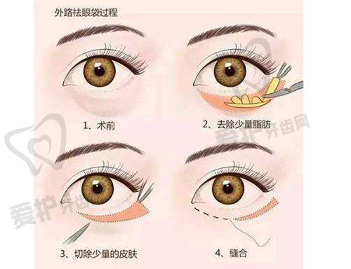 选择广州广大整形医院蒙石南医生:有哪些优势?