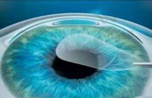 江门五邑爱尔新希望眼科医院:连锁专科的综合实力