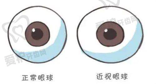 乌鲁木齐普瑞眼科医院半飞秒手术的优势有哪些?