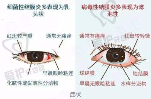 乌鲁木齐普瑞眼科医院不同科室营业时间有差异吗?