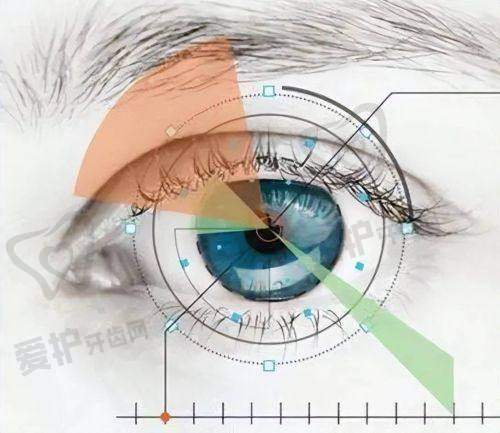 如何选择适合自己的半飞秒手术方案?