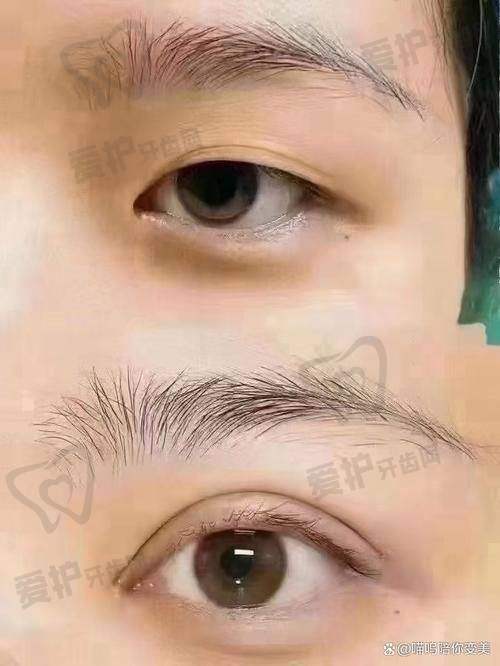 焦圆华医生:初眼整形的专精领航者是谁?