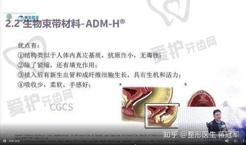 阴道紧缩术的价格是如何确定的?