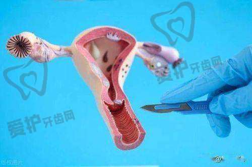 阴道紧缩术的成效能持续多久?