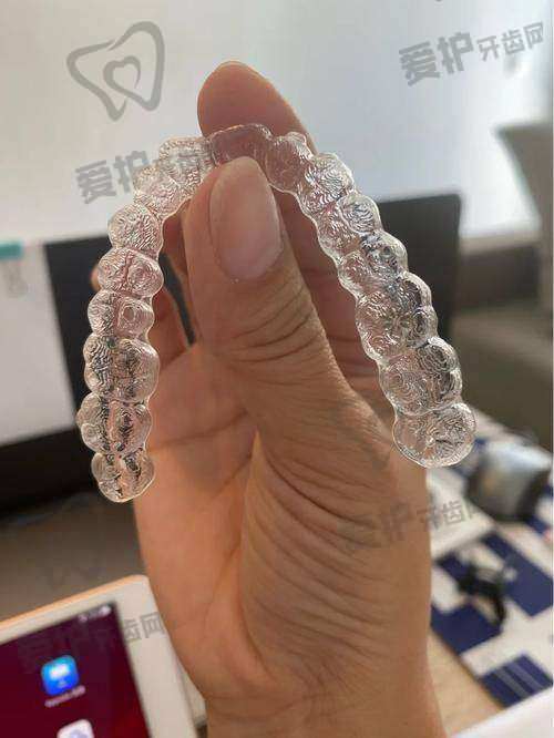 深圳正夫口腔医院隐适美隐形矫正36800元起，开启舒适美观矫正新体验 