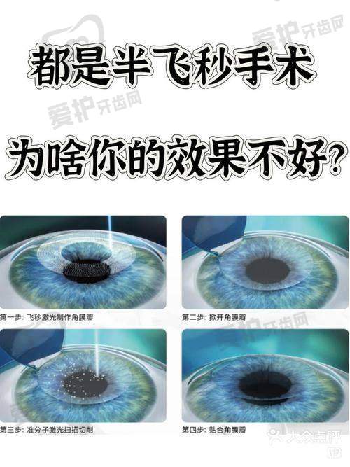 近视手术真的有风险吗?