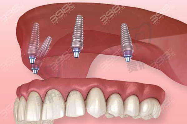 二、马鞍山鼎植口腔医院正规吗?