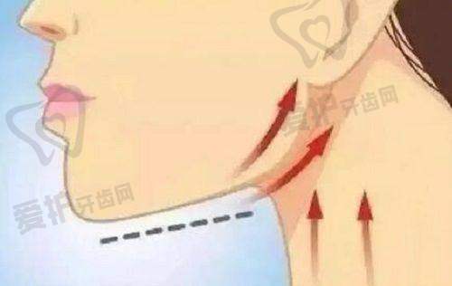 胸部异物取出的价格为何不同?