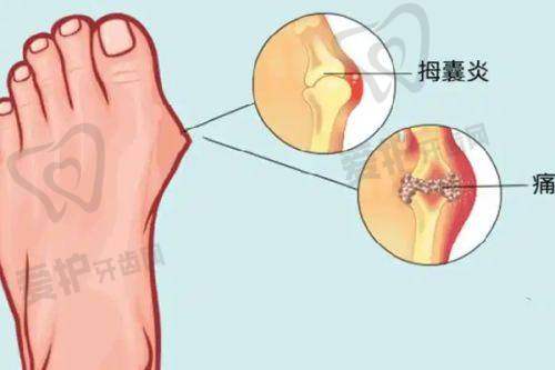 曼托水滴假体隆胸的价格是如何构成的?