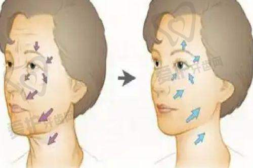 综合考量与决策