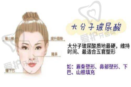 美波婷胶原丰胸的缺点