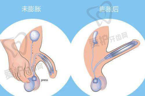 与其他整形医院相比,广州荔医整形医院的优势在哪里?综合实力突出