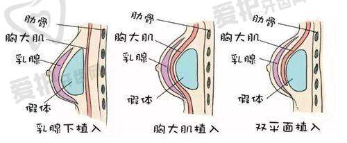 选择北京漾格和李在郁医生的理由