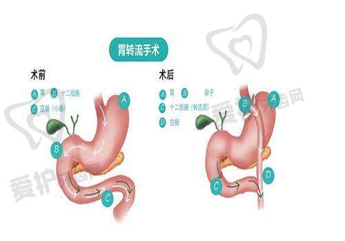 重庆军美和华美项目特色有何不同？