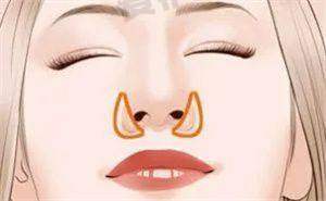 如何判断自己是否需要进行胸部异物取出手术?