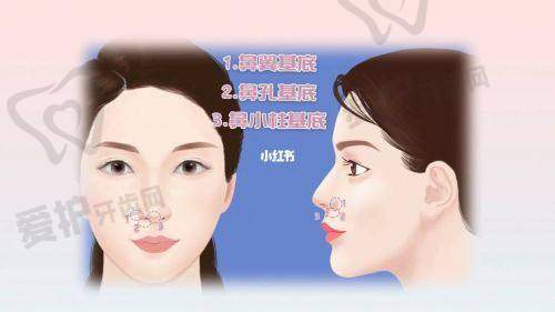 深圳阳光罗志敏医生患者评价