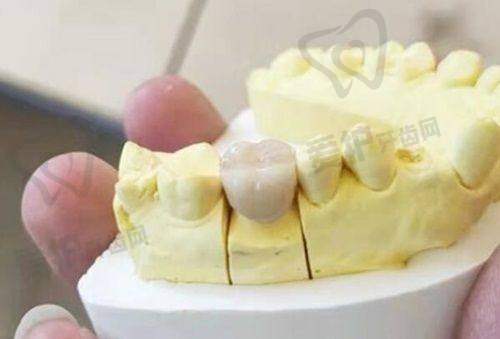 3、哈尔滨中航口腔赵德彪医生诊疗项目收费价格: