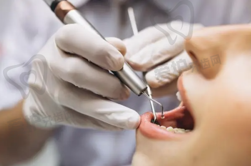 拔牙后饮食管理有哪些要点?