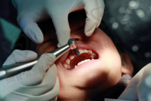 为什么说一般3 - 6个月种植牙较适宜?