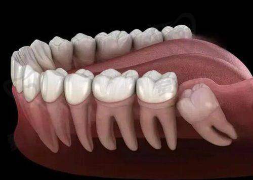 南宁诺贝尔口腔医院在陆冠充金属托槽矫正方面有哪些优势?