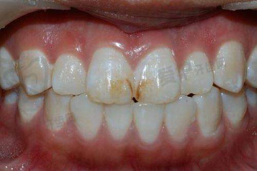 四、榆林市德系口腔门诊部坐诊医生: