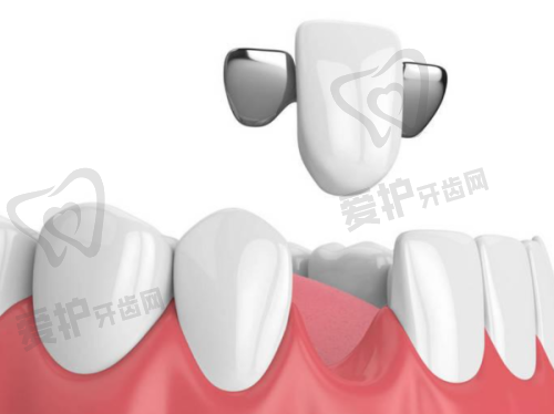 兰州诺贝尔口腔医院口碑好不好?