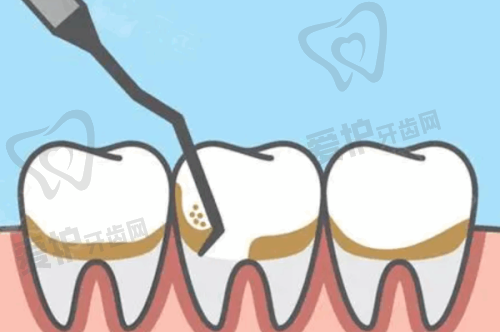 兰州诺贝尔口腔医院技术怎么样?