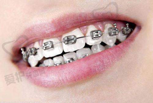 七、黑龙江哈尔滨中航口腔患者评价: