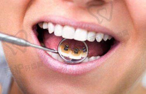 南宁诺贝尔口腔医院的患者评价如何?