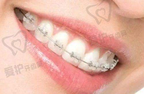 怎么前往兰州诺贝尔口腔医院?