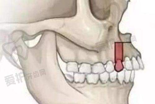 南宁诺贝尔口腔医院的服务贴心吗?