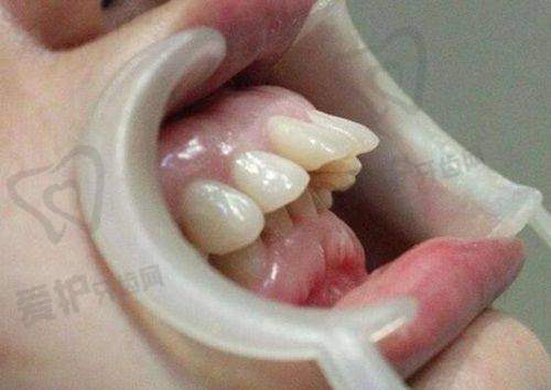 七、榆林市德系口腔门诊部患者评价: