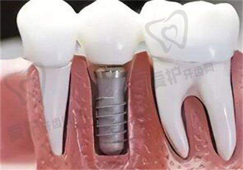 深圳登特口腔:高品质医疗与标准化服务