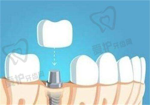 深圳佳美口腔:贴心服务与娴熟技术的结合