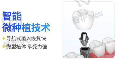 登腾种植牙的治疗过程是怎样的?