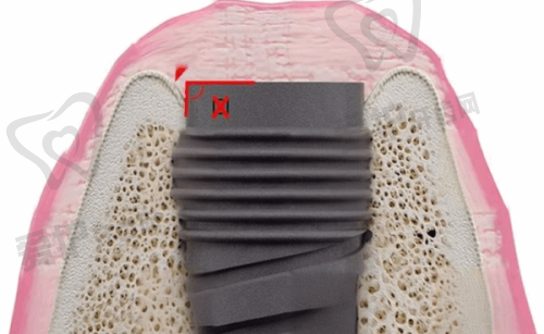 深圳麦芽口腔（南山分院）