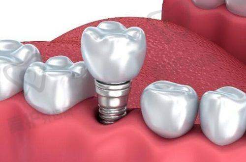 深圳正夫口腔:连锁规模与亲民价格