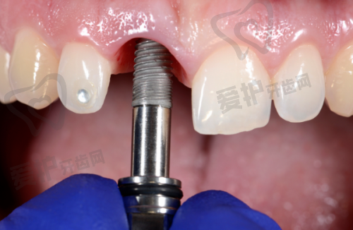 深圳博爱曙光口腔:精良设备与个性化诊疗