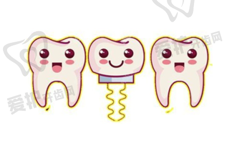 兰州诺贝尔口腔简波简院长做登腾种植牙3680元起，专业可靠值得选择 