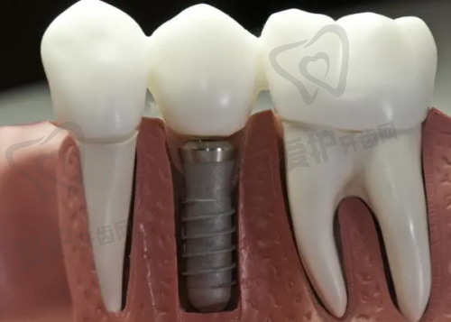 深圳世纪河山口腔:高品质服务与透明价格