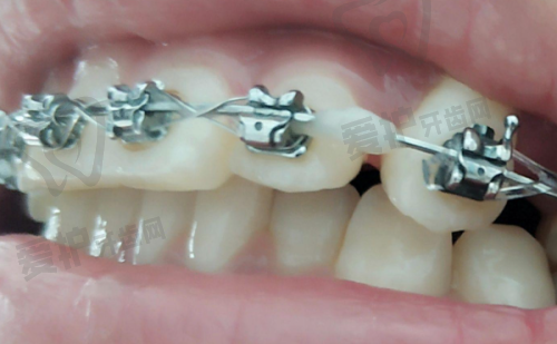 2、哈尔滨中航口腔赵德彪医生种植牙怎么样?